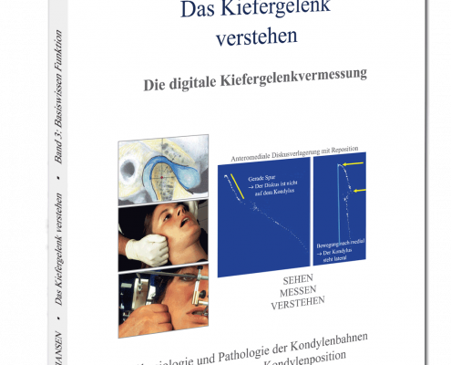 Cover-Kiefergelenk-verstehen